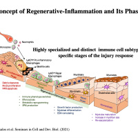 The concept of regenerative inflammation